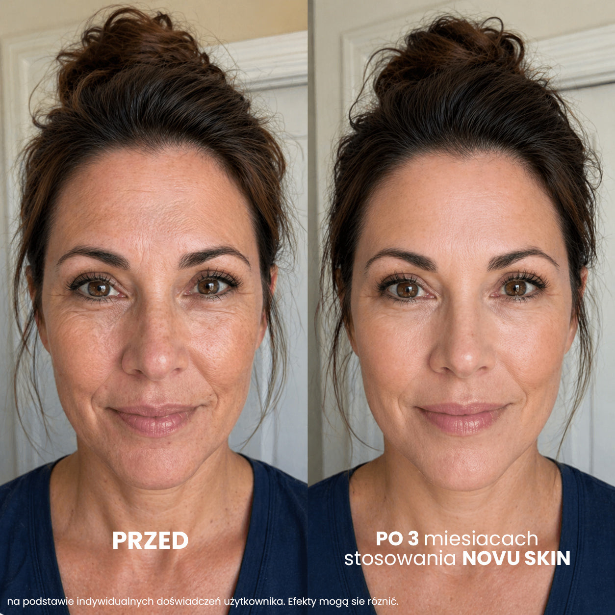 NOVU SKIN MesoInfuse – sada proti vráskám a pro hydrataci